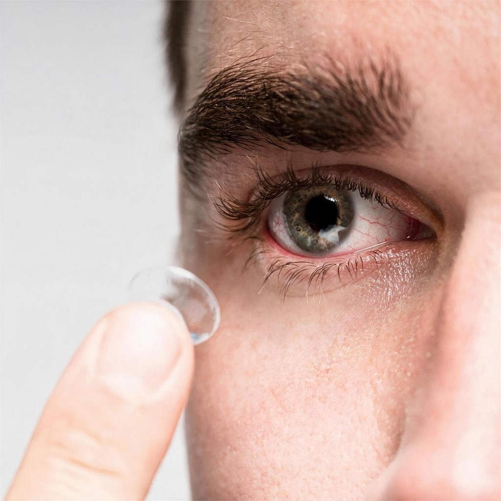 ¿Se pueden usar lentillas si tienes los ojos secos? Nuestros optimetristas en Noia responden