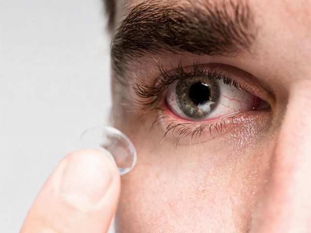 ¿Se pueden usar lentillas si tienes los ojos secos? Nuestros optimetristas en Noia responden